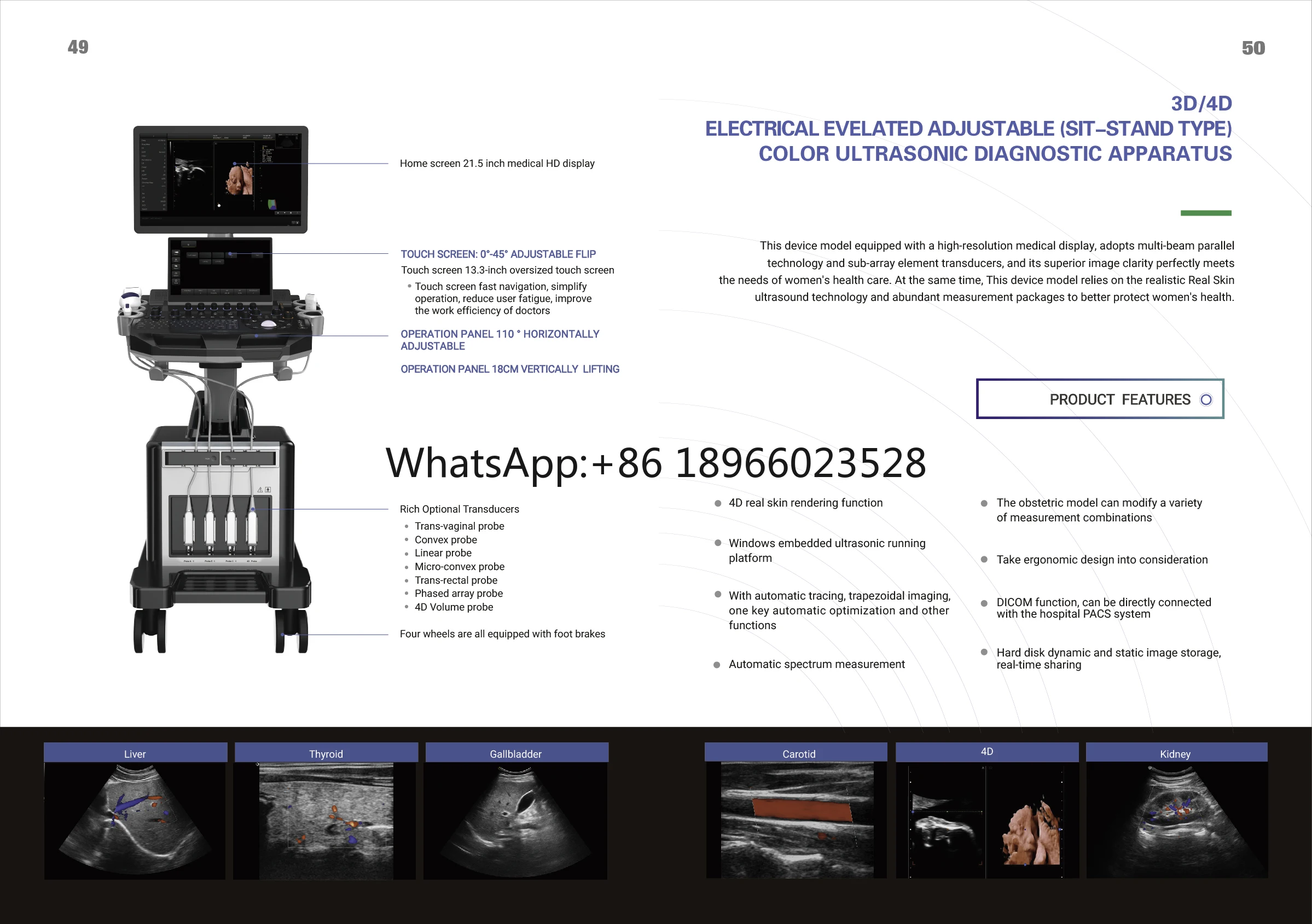 SUNNYMED Trolley Color Doppler Ultrasound Machine with 4D Function