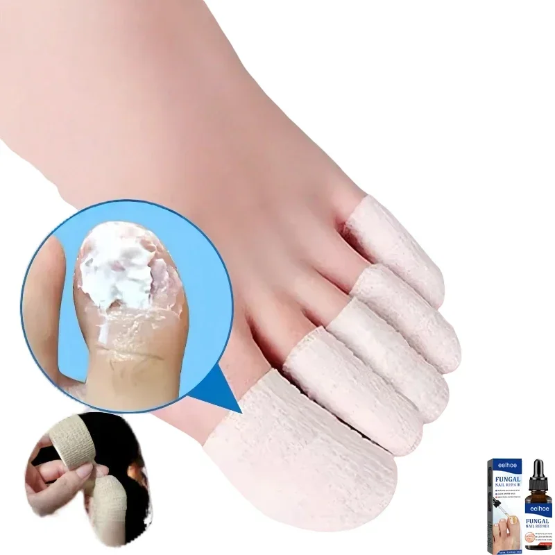 Esmalte para hongos en uñas, recubrimiento para uñas, protección para dedos de pies y manos, vendaje autoadhesivo 3