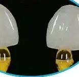 

10Pcs Dental Refill Bonding Stick Veneer Crown Matrice Adhesive Brackets Rods Dentisty Dental Tools