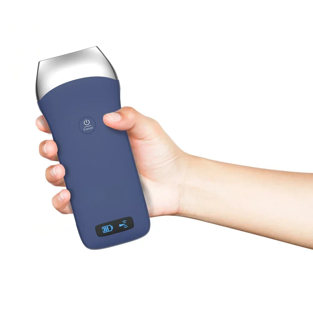 Wireless Ultrasound Linear 250 Gram Handheld Portable Scanner