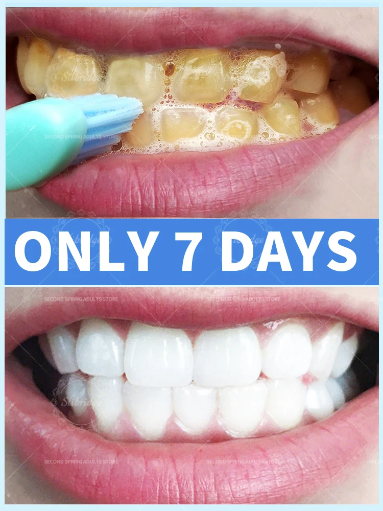 

Hot selling Tartar removers dissolve tartar and remove stains