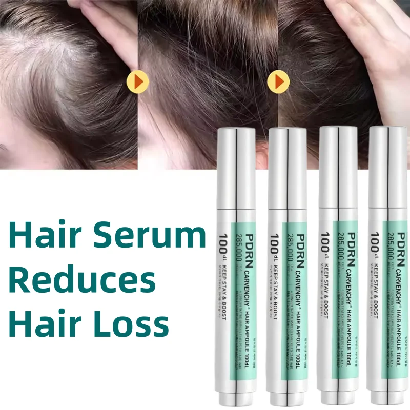 

Korean Anti Hair Loss Scalp Essence Pdrn Scalp Care Solution Reduce Shedding Promotes Growth Soothing Care Thicker Stronger Hair