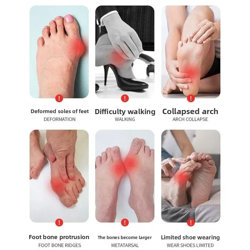 Unisex Bunion correction Adjustable Bunion Fix for Big Toe Separation Pain Relief - Orthopedic Bunion Splint with Straightener