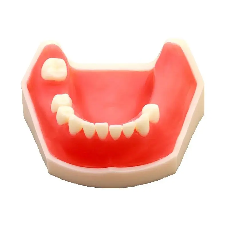 High Quality Dental M2009 Implant Practice Model for Medical Demonstration