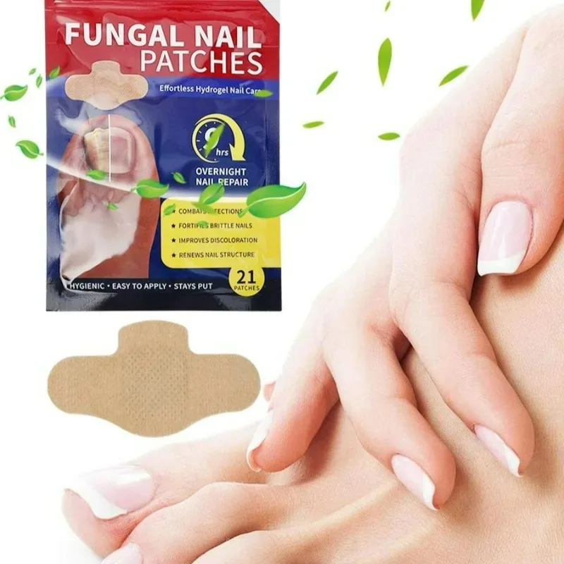 21/105Pcs Super-effective Nail Repair Patches 9hours Persistent Efficacy Paronychia Toenail Care Nail Ingrown Correction Sticker