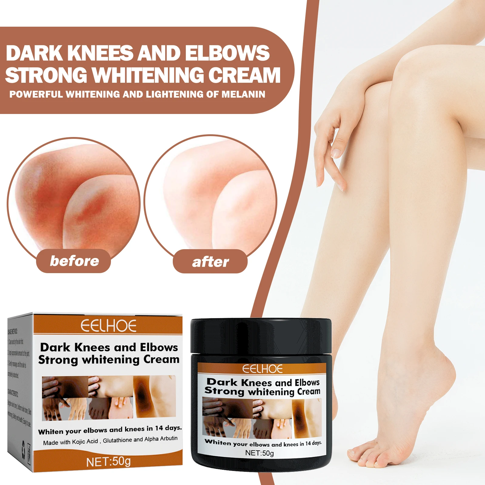 50g Kojic Acid Whitening Cream Diminish Melanin In Joints Knees Hands Improve Dullness Moisturize & Brighten Body Care Products