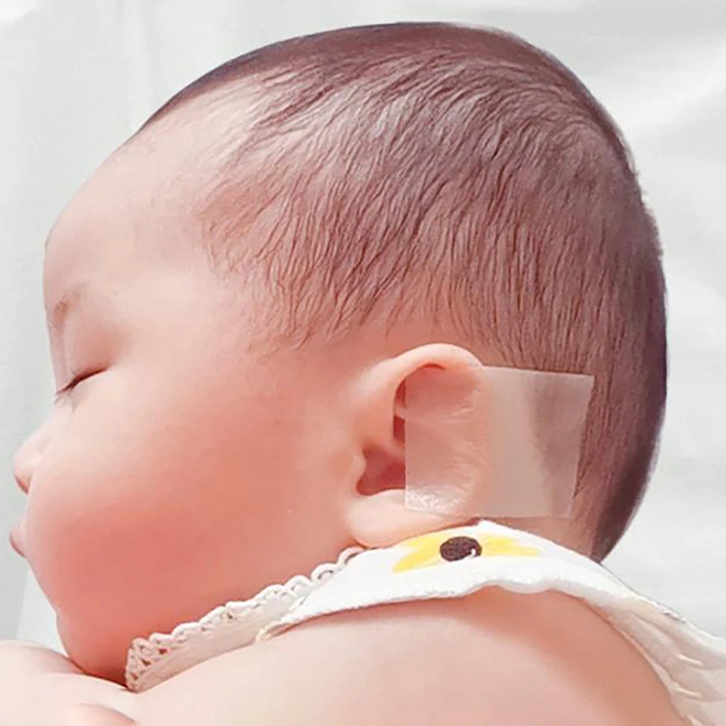 Baby Ear Corrector Cuttable Breathable Infant Toddler Auricle Valgus Silicone Correction Patch with Ear Support Patches