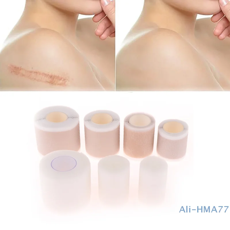 Silicone Gel Scar Sheet Patch Treatment Removal Tape Acne Trauma Burn Scar Cover Skin Repair Section Ear Beauty