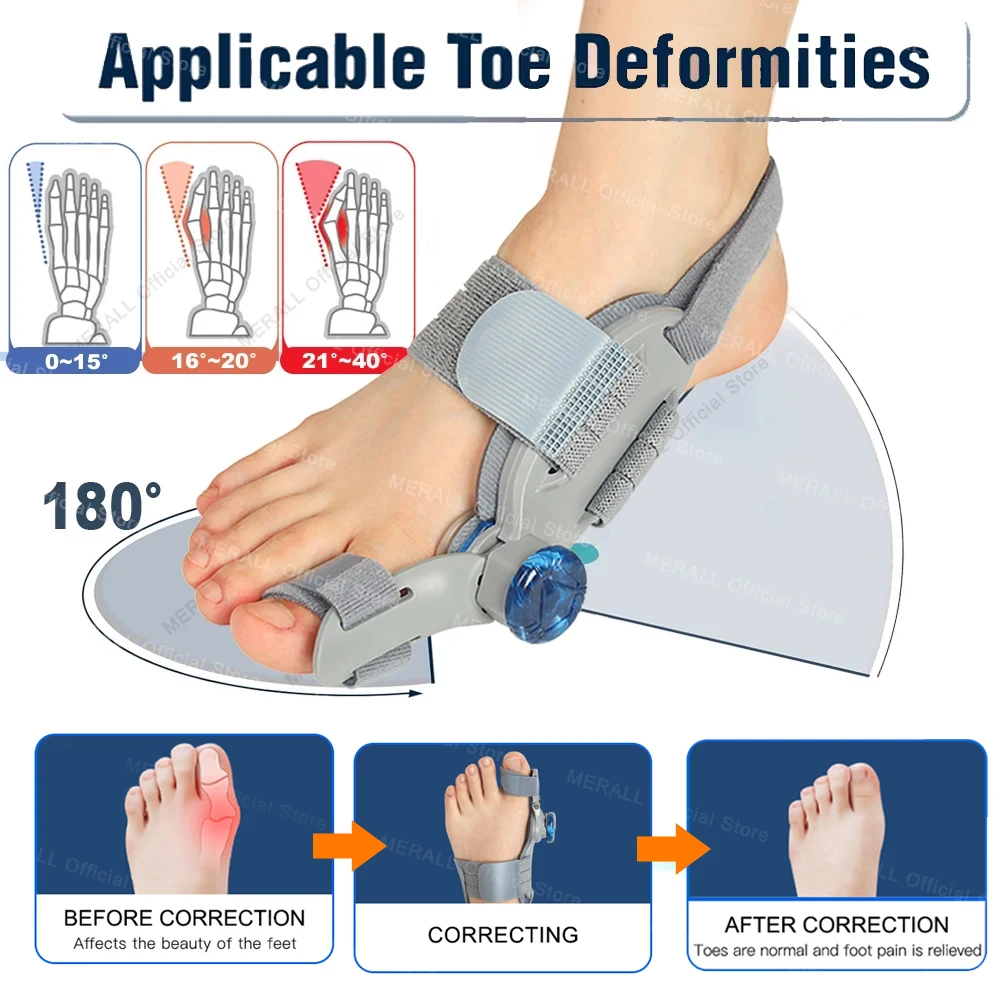 Adjustable Bunion Corrector Toe Separator Hallux Valgus Relief Toe Corrector Straightener Finger Correction Orthopedic Pedicure