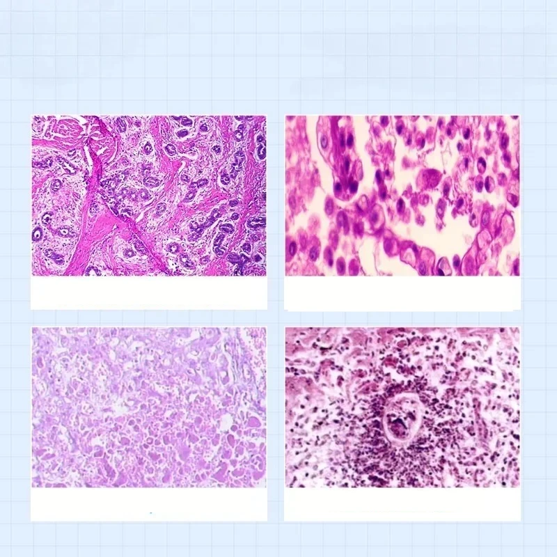 100PCS Medical Pathological Sections Human Body HE Staining Typical Tissue Specimen Slides Microscope Glass Slice