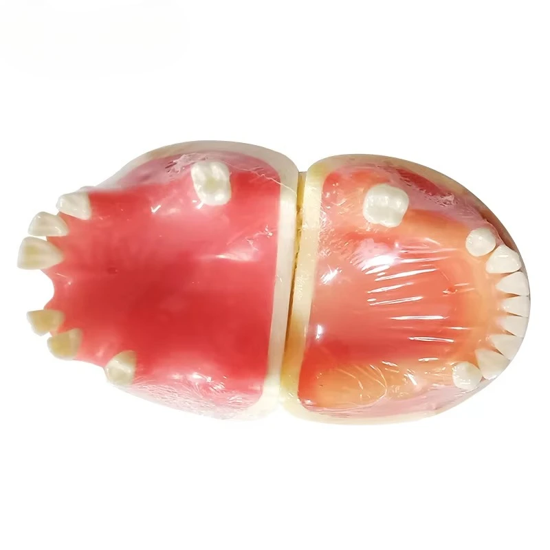 ImplantS Models Partially Edentulous Models Can Be Made with Incisions and Sutures