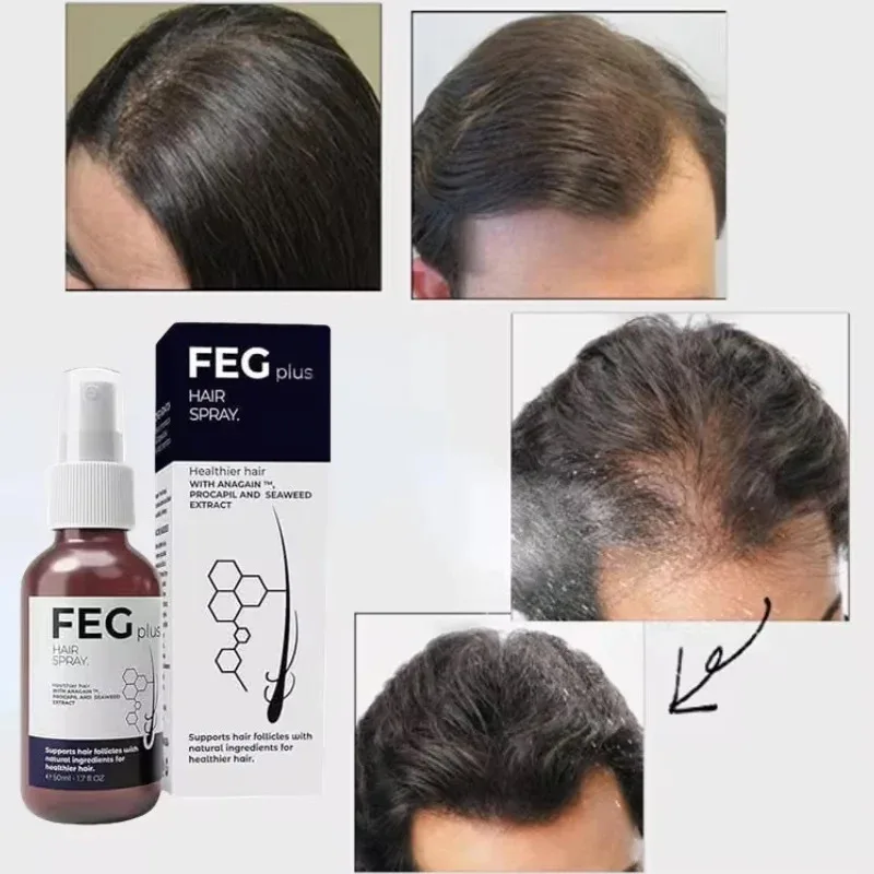 2025 Hot Selling Professional 50ml Organic FEG  PLUS  Damaged Hair Care Treatment Regrowth FEG Hair Growth Spray For Thicker