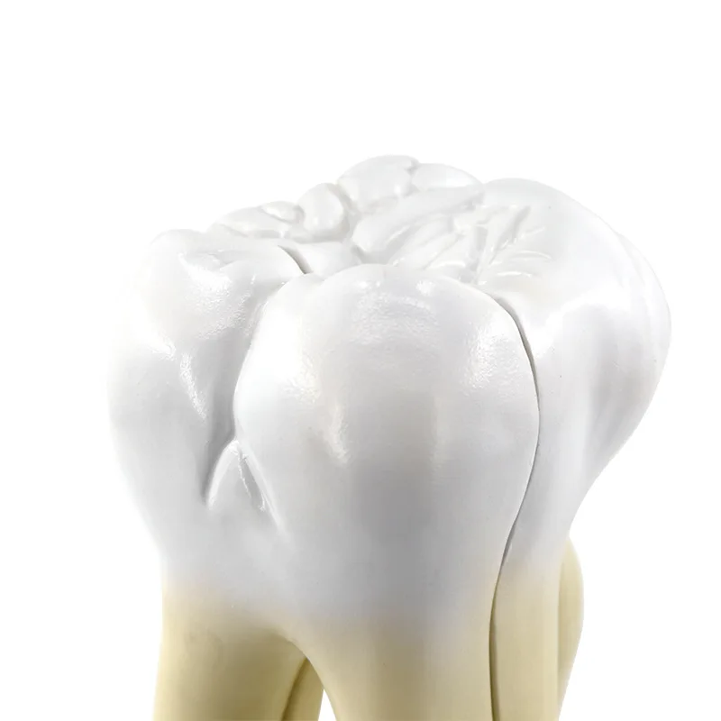 10 times large tooth pathological cavity anatomy model removable molar caries teaching dentals model