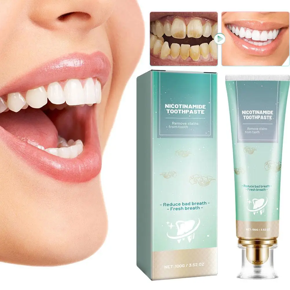 

100g Nicotinamide Whitening Toothpaste Bright White Toothpaste, Enamel Strengthening & Fresh Breath, Helps Fresh Breath