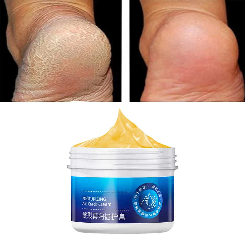 Anti-Trocknungs-Riss Hand Fußpflege Creme Ferse rissige Reparatur produkte Entfernung abgestorbene Haut feuchtigkeit spendende Bleaching nähren Hautpflege