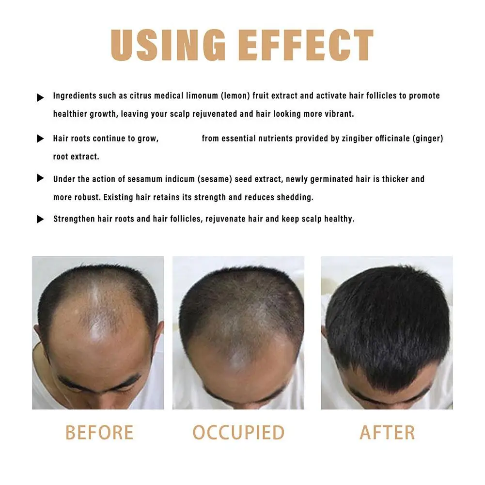 شامبو منشط الجذر، بلسم إعادة نمو الشعر الرمادي، صابون شامبو لتقوية الشعر من أجل لهاي ناعم وقوي Z4R9 #5