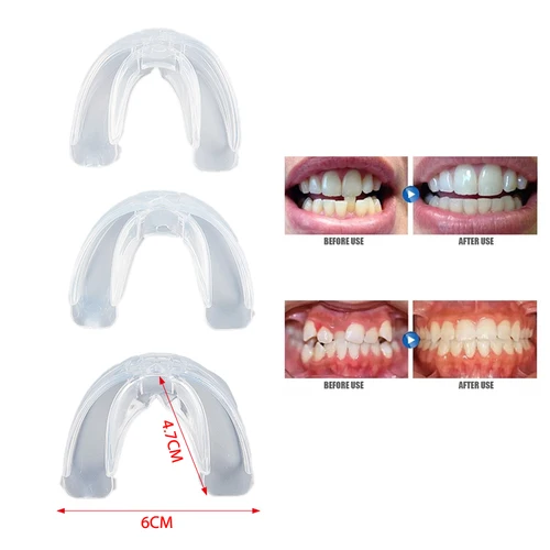 Corrector de dientes de ortodoncia Dental, retenedor de soportes de silicona, herramientas para enderezar, dientes con tapa para adultos, herramientas de cuidado Dental, 3 fases