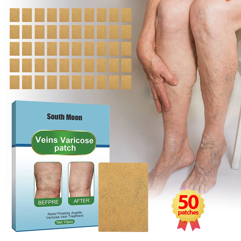 

50Pcs Varicose Veins Treatment Patch Angiitis Legs Dilated Relief Vasculitis Phlebitis Spider Leg Varicosity Foot Care Medicine