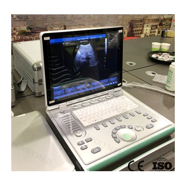 

SY-A009 High Quality Image Display 3D Function Professional Portable Laptop Ultrasound Scanner Device Price