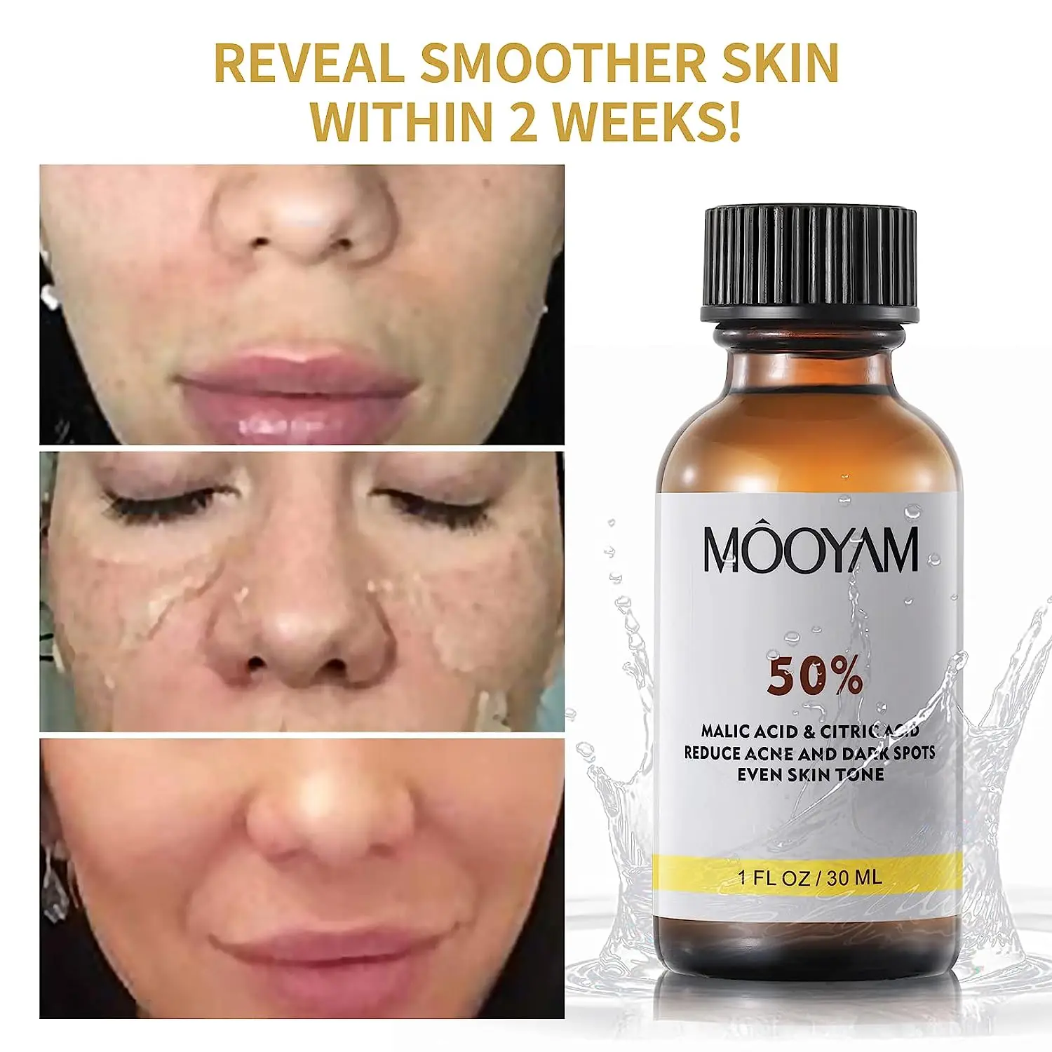 TCA 50% Acid Skin Peel Salicylic Acid Skin Peel Care Peeling Wrinkles Spots Skin Care Face Serum