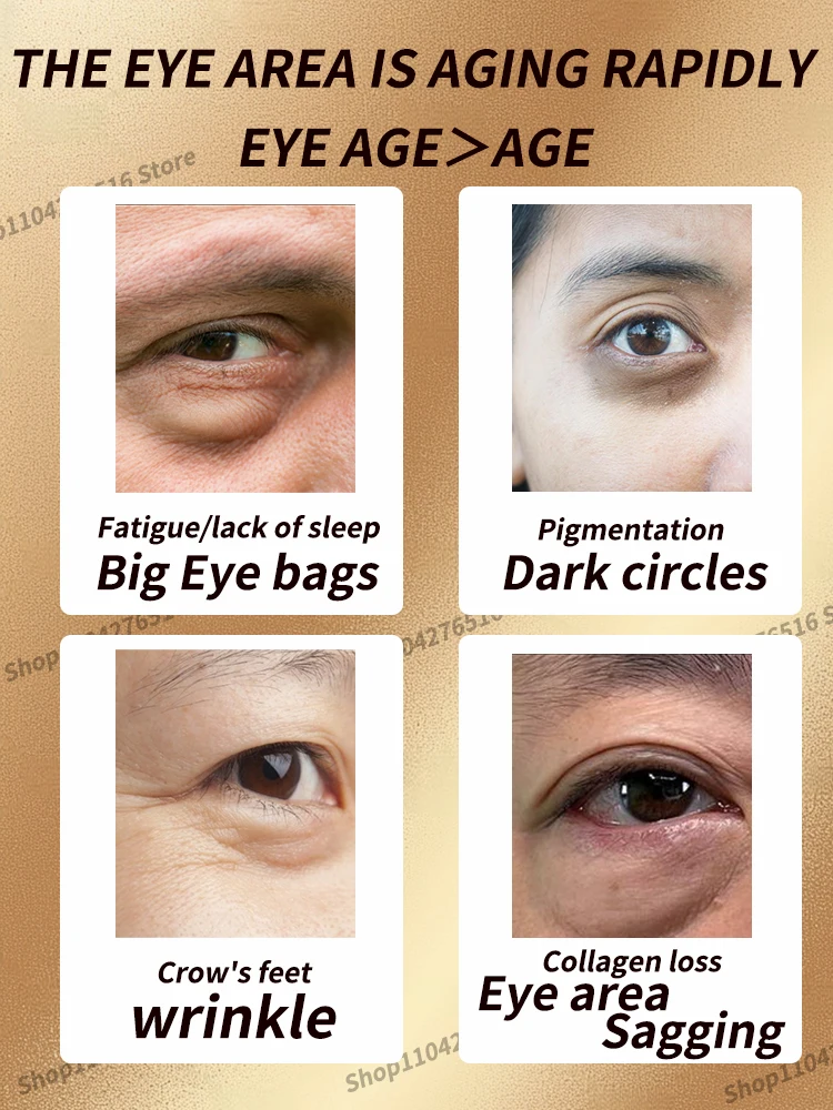 

How to improve eye bags, dark circles and fine lines without worries