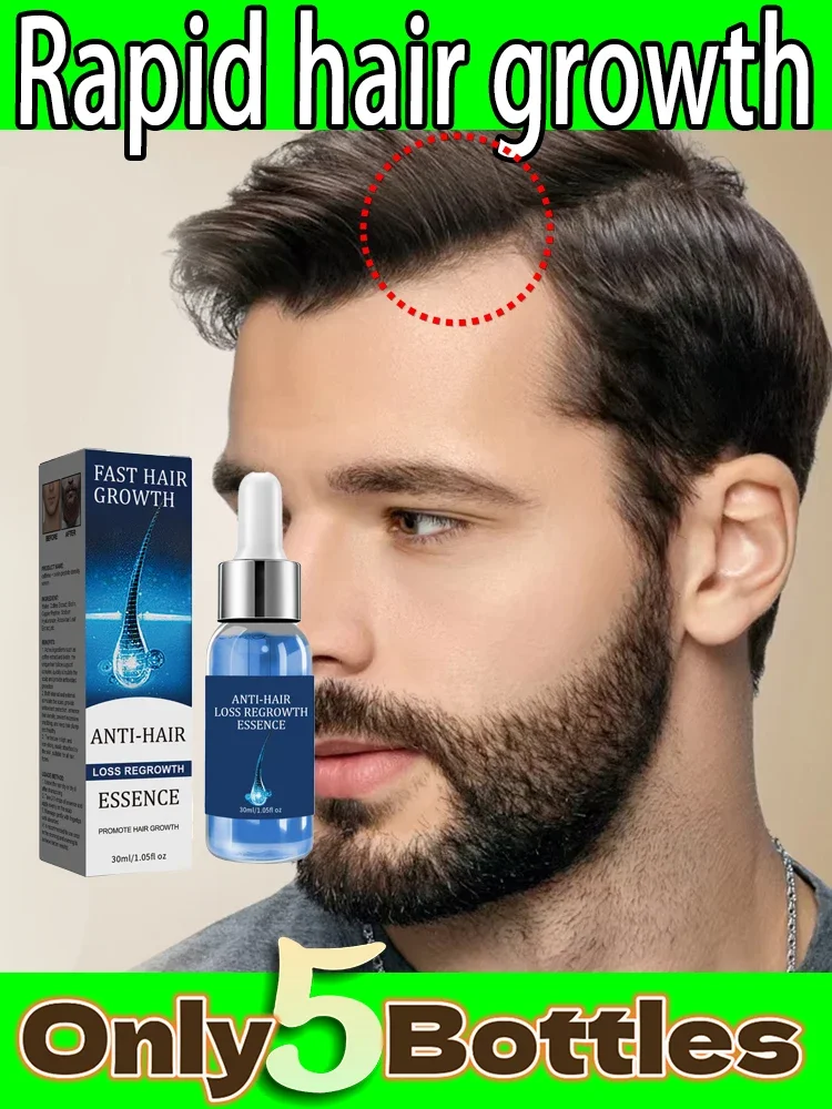 Fast Hair Growth Oil Effective Baldness Repair Hereditary Hair Loss Postpartum Hair Loss Seborrheic