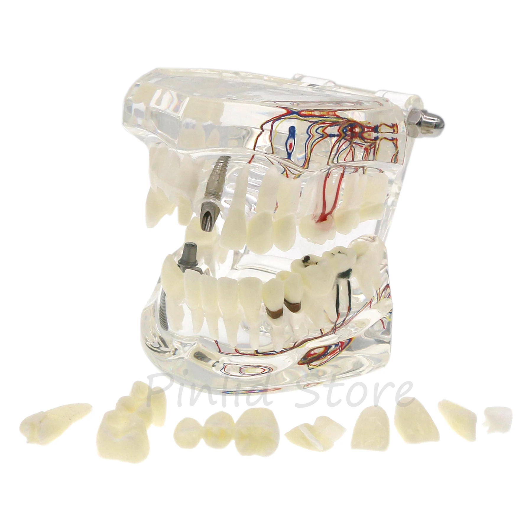 Dental Models for Implant Analysis Dental Students learning to teach Dental Practice Presentation tools