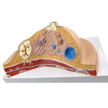 Modelo de lesão mamária humana feminina modelo de anatomia mamária quiescente ambientalmente amigável modelo de exibição de ensino médico