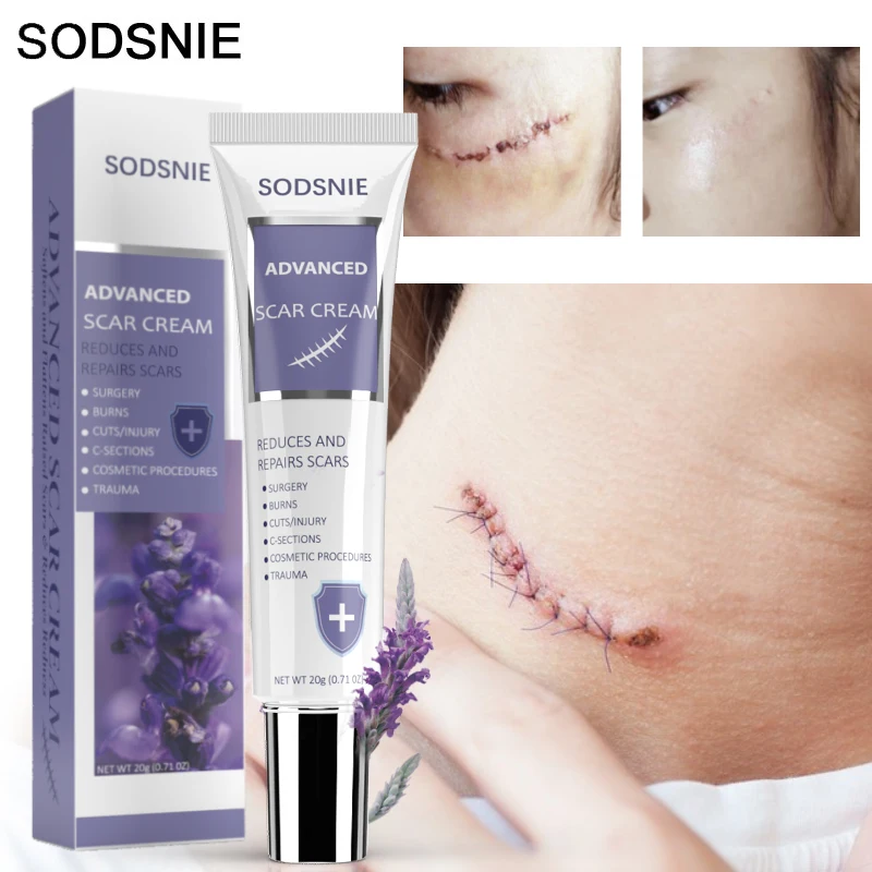 Advanced Scar Cream Skin Repair Scars Treatment Smooth Whitening Effective Remove Burn Stretch Marks Acne Spots Body Care 20g