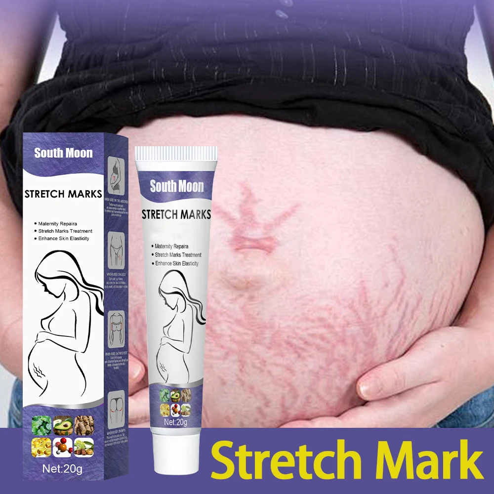 

Skin Care Firming Remove Stretch Marks Pregnancy Improves Elasticity Fade Growth Lines Smoothing Nourishing Moisturizing