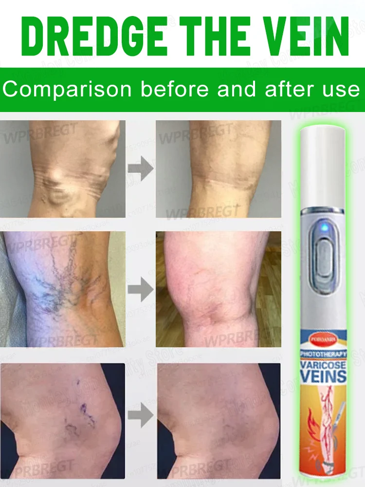 Bescherm uw gezondheid, laseraanwijzer