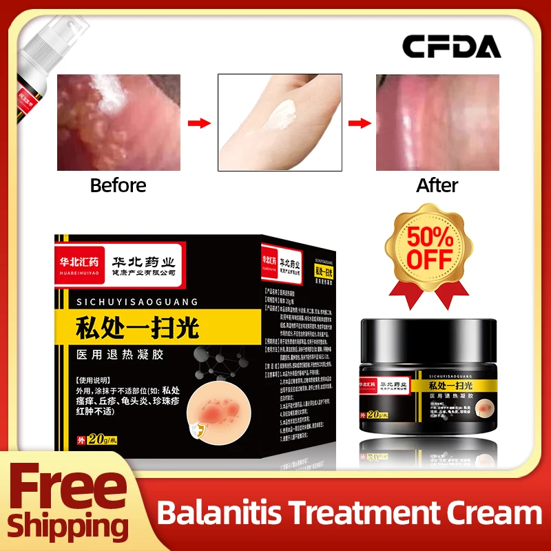 

Balanitis Treatment Medicine Cream Apply To Pearl Rash Itching Bacterial Infection Cure 20g/bottle CFDA Approve Glans Spray