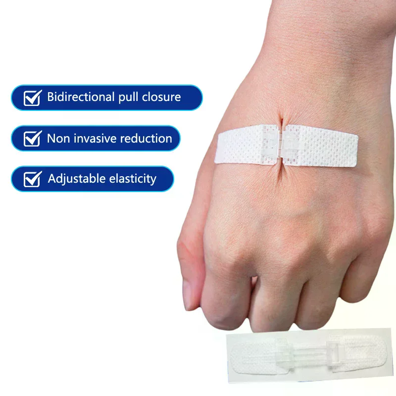 

Пластырь на молнии, безболезненный пластырь для закрытия ран, без швов, пластыри для перевязки на рану, редуктор швов на молнии, пластырь для улицы, портативный