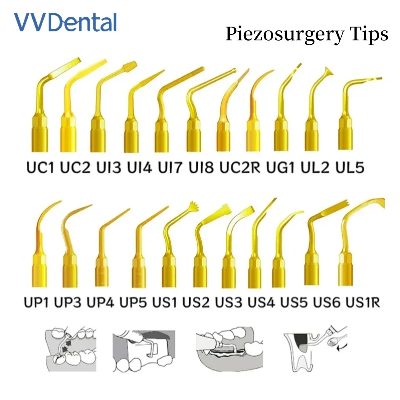 VVDental Piezosurgery Tips Kit Ultrasonic Dental Inserts Bone Cutting Sinus Lifting Implant Perio Scaling Fit Woodpecker Mectron