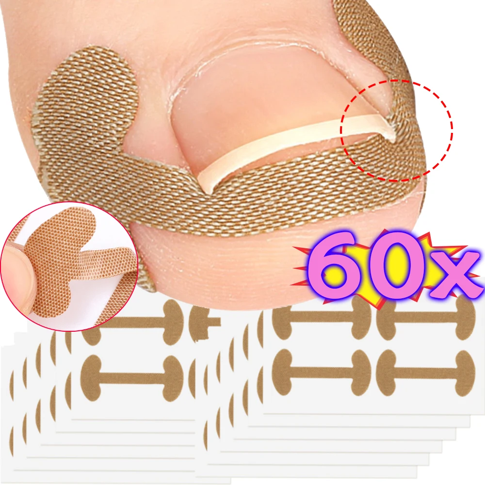 20/40/60Pcs Ingrown Paronychia Toenail Corrector Strips Anti Fungal Nail Correction Stickers Anti Infection Nail Treatment Patch