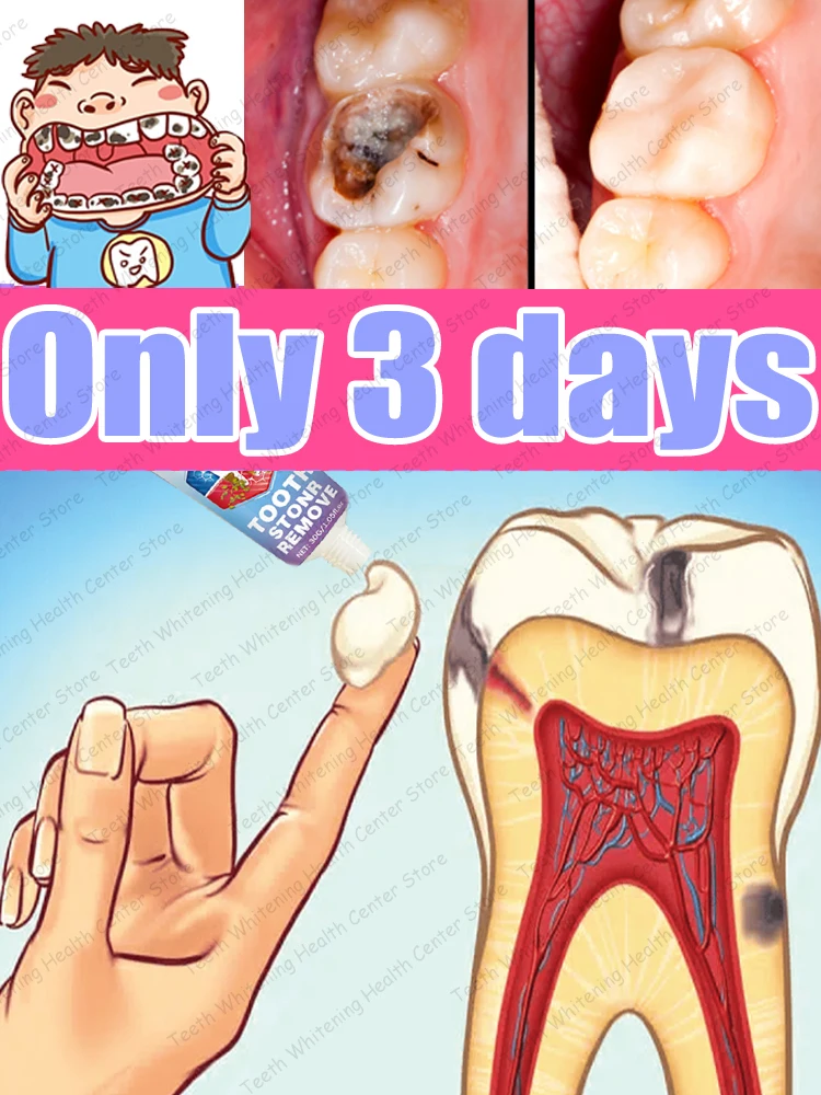 

Contains probiotics to remove tooth decay