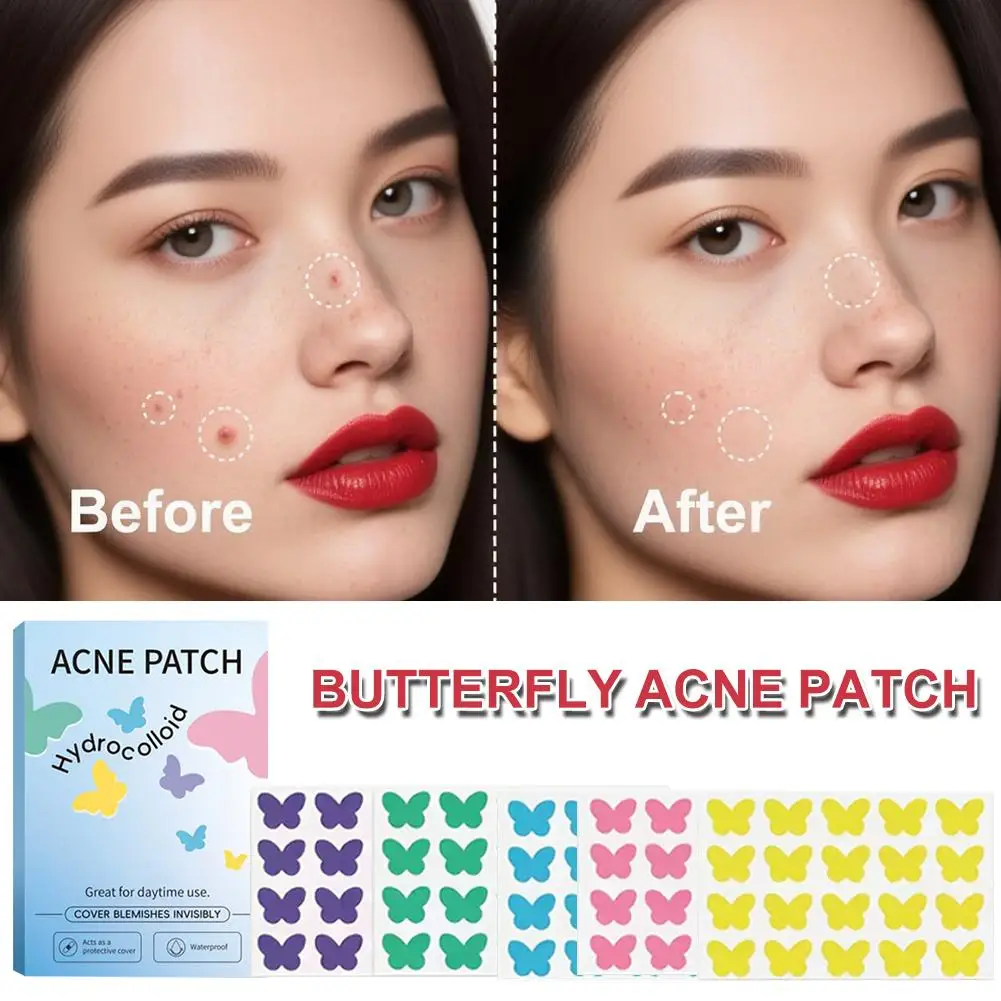 Plasterki na pryszcze w kształcie motyla, naklejki na wypryski, korektor na niedoskonałości, zakrywanie, leczenie trądziku, usuwanie pryszczy, pielęgnacja skóry