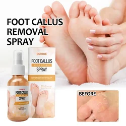 Foot Callus Remover Spray Quickly Soften Calluses Exfoliation Dry Feet Skin Hydrating clean Dead repair Skin cuticles Foot Care