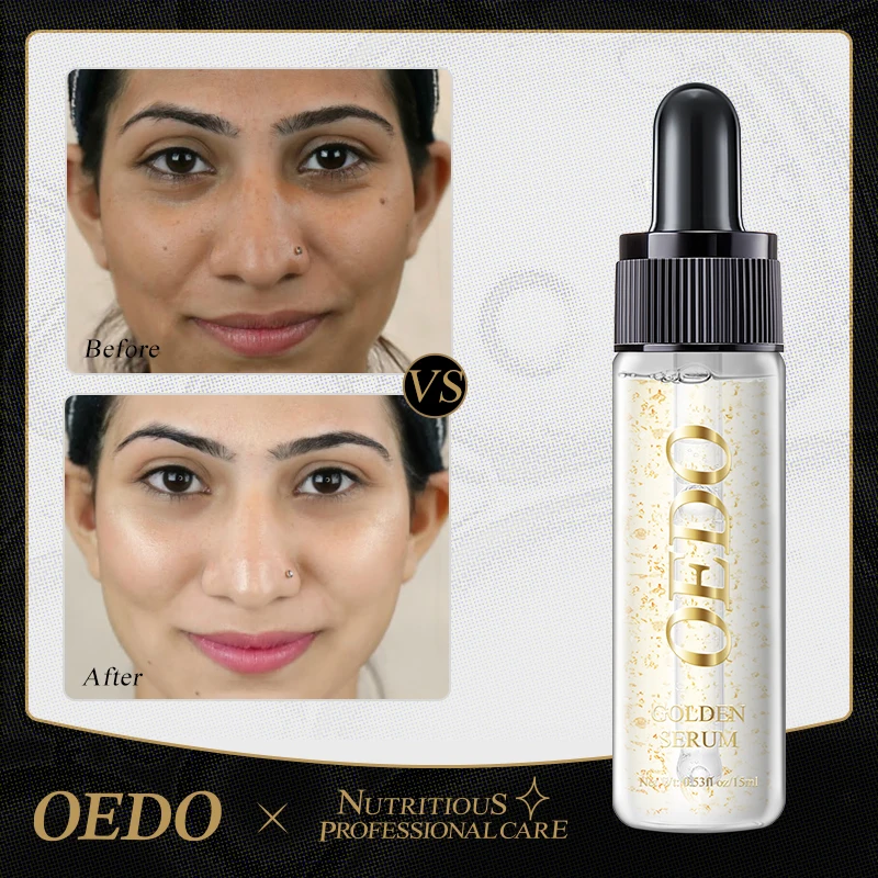 OEDO Gold Serum Anti-Aging Fade linee sottili profondamente nutriente idratante idratante migliora il tono della pelle essenza per il trattamento