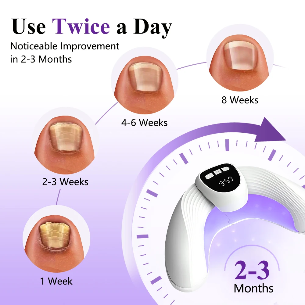 2-in-1 Nail Fungus Laser Device for Multiple Toenails Fingernails Electric Fungus Onychomycosis Remove Toenail Treatment Machine