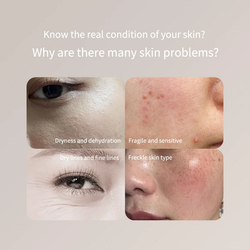 เครื่องทดสอบผิว ใบหน้า ความชื้นของผิวและปริมาณน้ํามัน เครื่องวิเคราะห์ผิวหนัง น้ําผิวแก้ม ยืดหยุ่น เครื่องวัดอายุของผิวหนัง เรืองแสง