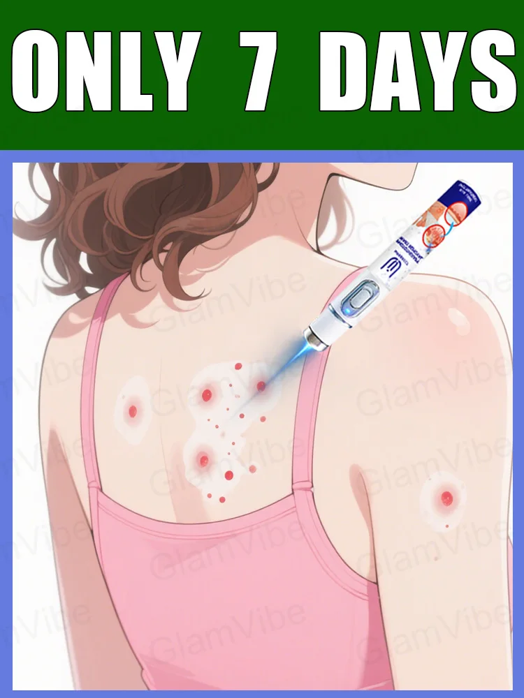 

blue light pen solve warts, hot sale wart care tools