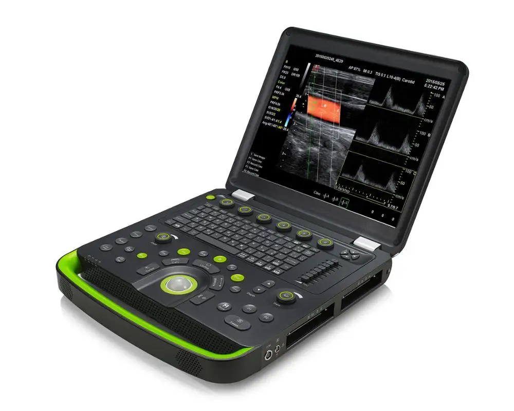 Portable Color Doppler Ultrasound Scanner /Diagnostic Ultrasound System For Hospital/clinic (MSLCU56)