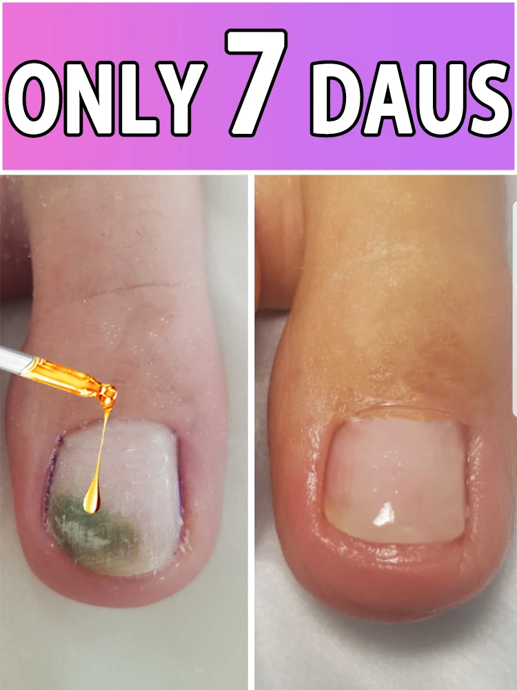 

Gentle penetration , restore natural radiance