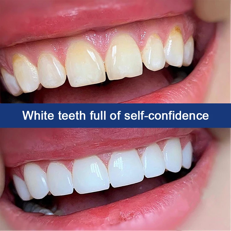 Whitening Toothpaste Fresh And Bright Breath Removing Stains Cleaning Teeth Odour Removal Bad Breath Preventing Periodontitis