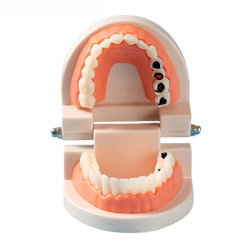 JAVIDENT 1Pcs Dental Teaching Models Teeth Whitening Removable Dentures Practice Resin Tooth Models R Oral Demonstration Tools