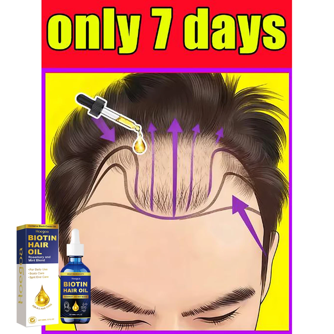 

Biotin fast Hair Growth oil Products Care Scalp Massage Treatments Anti Hair Loss Effective Grow Thicker Hair serum for men