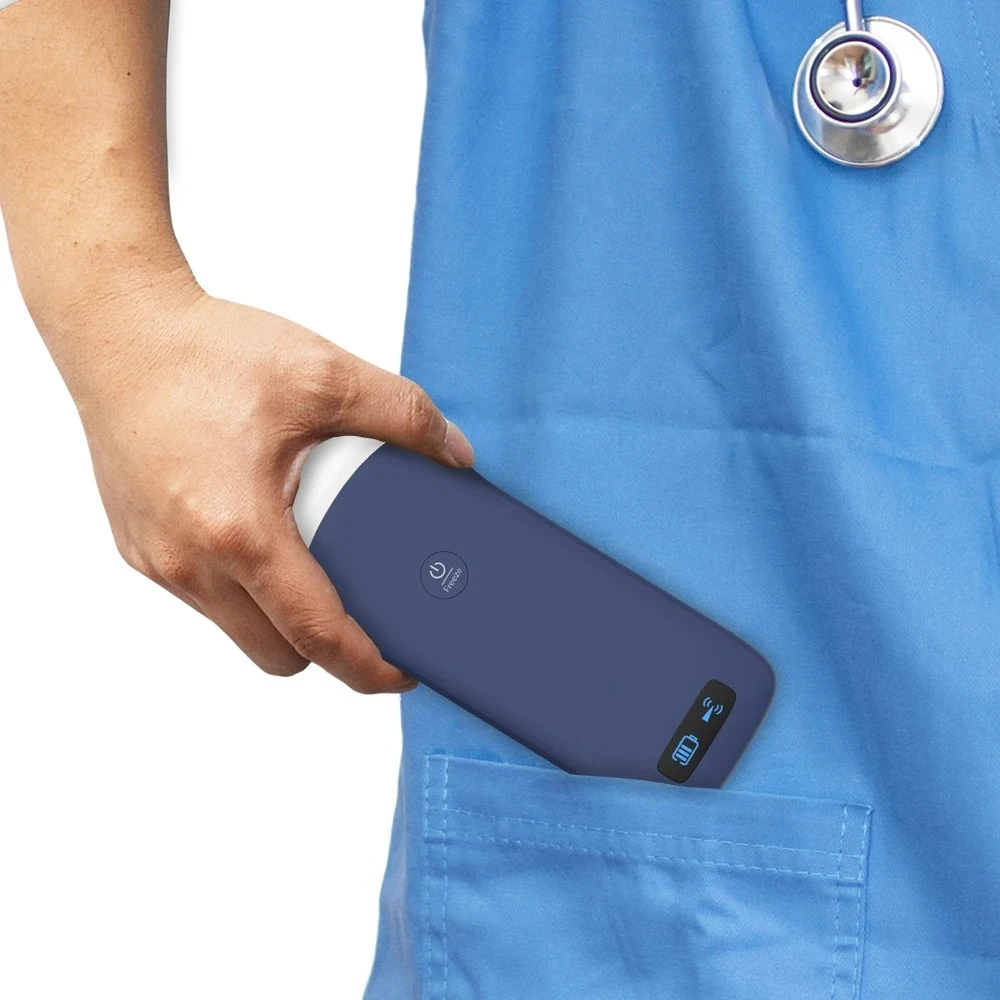 

Hot Sale Can Effectively Diagnose Muscle Pathology by Providing Real-time Imaging,dynamic Evaluation of Muscle Contraction