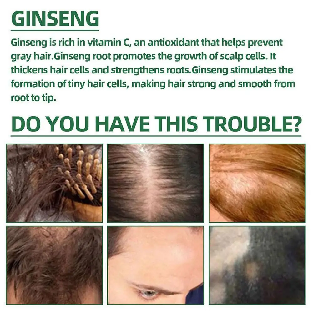 Powerful Hair Growth Oil Prevent Hair Loss Products Essence Neo Genuine Ginseng Extract Hair Growth Spray Hair Anti-Fall