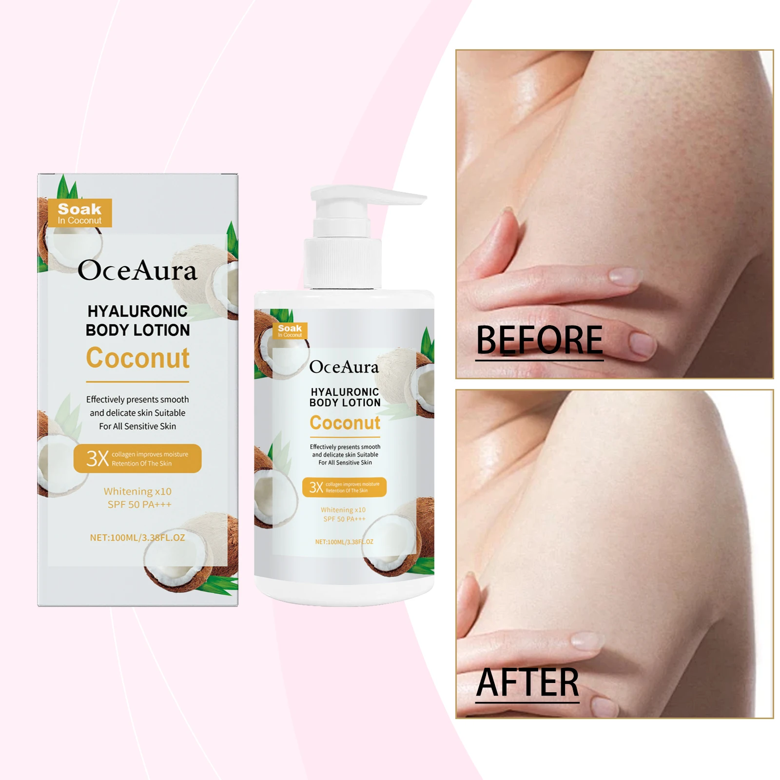 코코넛 히알루론산 바디 로션 - SPF 50 PA+++ 민감성 피부를 위한 화이트닝 & 하이드레이팅 모이스처라이저, 3X 스무딩 효과, 100ml/3